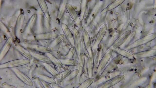 Microscopic view of jellyfish tentacle under microscope 