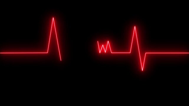 Heartbeat Pulse Line Animation, ECG Electrocardiogram Monitor Loop