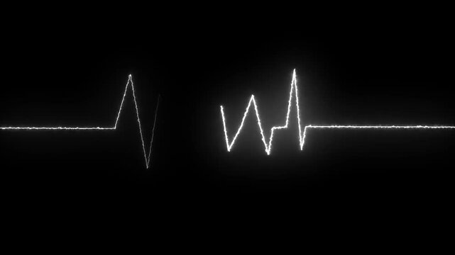 Stark white ekg heartbeat monitor line displaying vital signs against a solid black background
