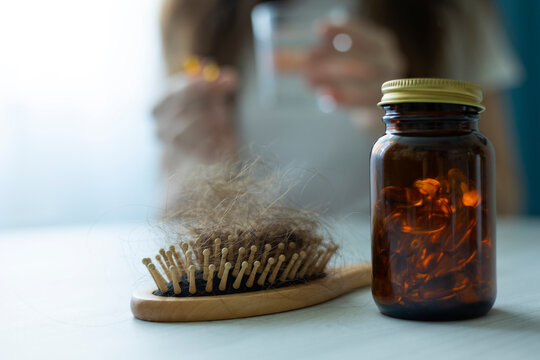 Close up of excessive hair loss and shedding on a hairbrush, representing hair health problems and alopecia