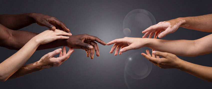 Diverse hands reaching towards each other with different skin tones and vitiligo on dark background, symbolizing unity, tolerance, inclusion, and human connection for diversity campaigns