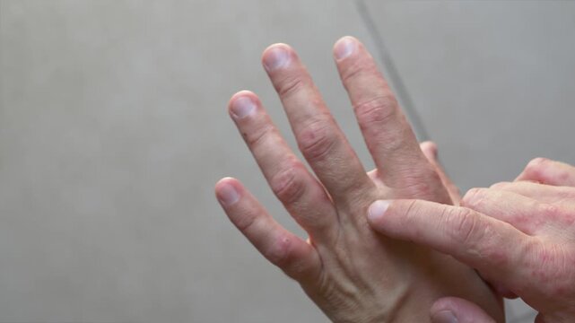 Hand scratching irritated skin with visible redness and rash. Close-up dermatology concept showing itching, skin irritation, allergic reaction and discomfort. Red rash spots and irritated skin 