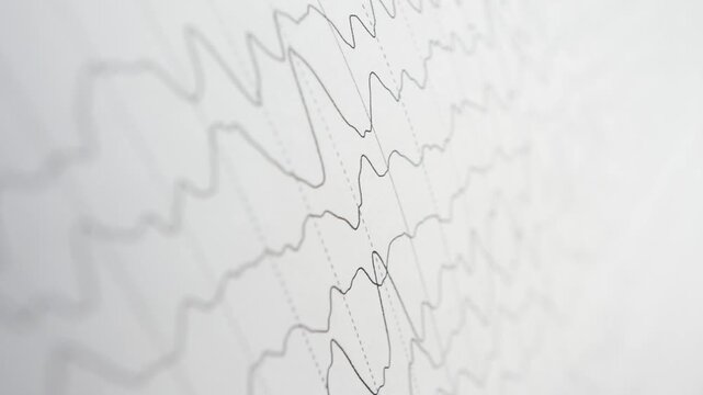 Close-up of EEG Brain Wave Activity on Medical Paper