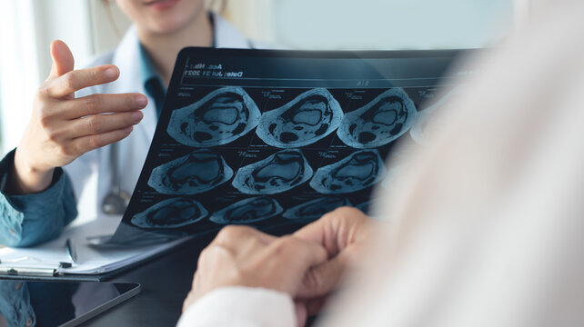 Doctor examining MRI medical scan film of osteoarthritis in senior patient at hospital or medical clinic. healthcare and medicine concept.
