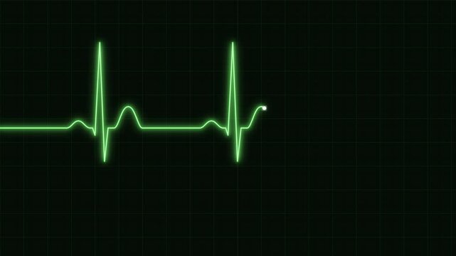 Vibrant green electrocardiogram ECG waveform on a medical screen, symbolizing a healthy heart rhythm and life.