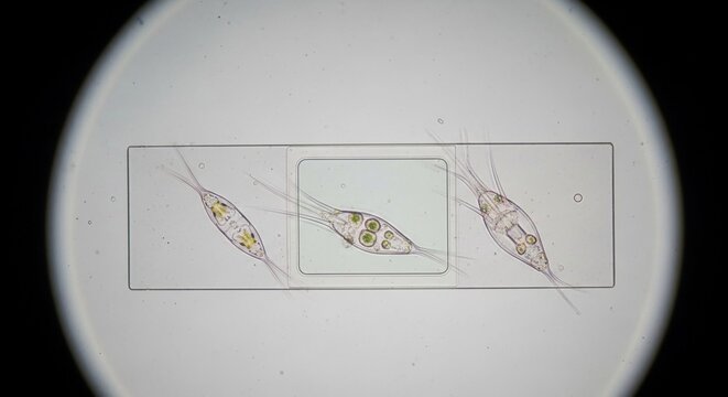 Microscopic marine organisms observed on a laboratory slide