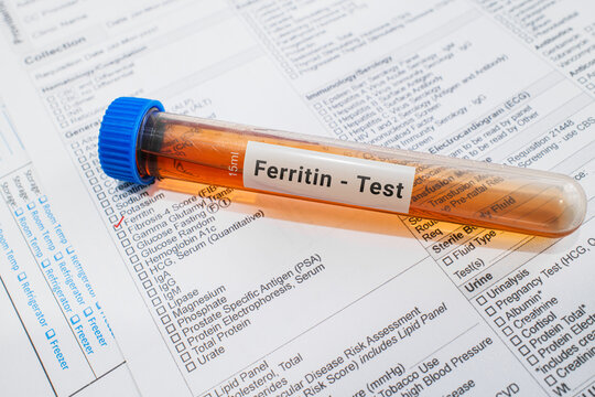 blood sample in lab test tube for Ferritin test
