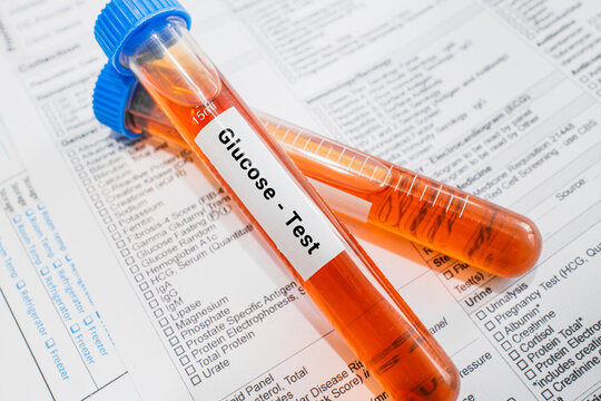 blood sample in lab test tube for Glucose test