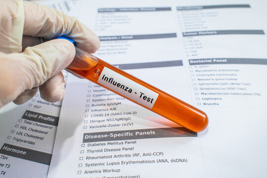 blood sample in lab test tube for Influenza test