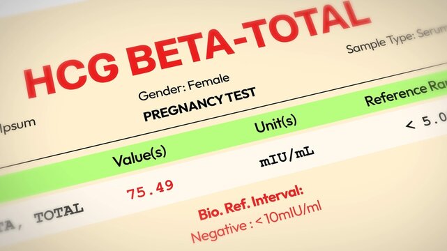 Pregnancy test results sheet with hcg beta-total levels and reference range, 4k animation.