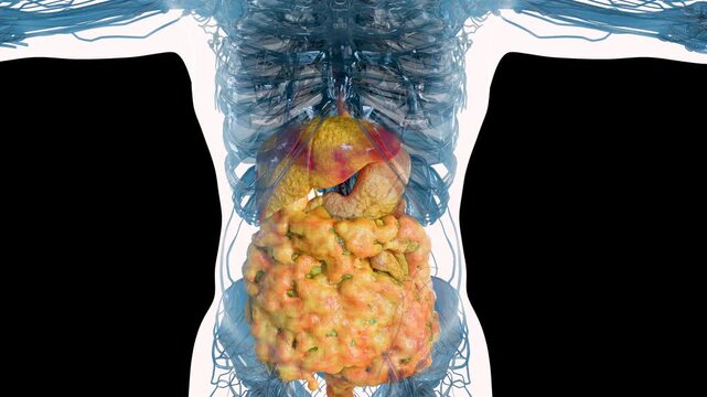 Progressive Accumulation of Visceral Fat and Fatty Liver Disease, Metabolic Syndrome and Internal Fat Gain, Liver and Abdominal Fat Progression, Advanced Steatosis and Visceral Obesity, 3d render