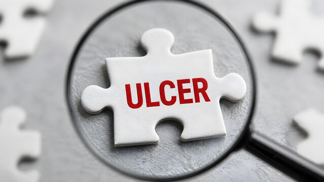 White medical puzzle piece marked ulcer under a magnifying glass representing gastrointestinal diagnosis healthcare research symptoms and clinical investigation