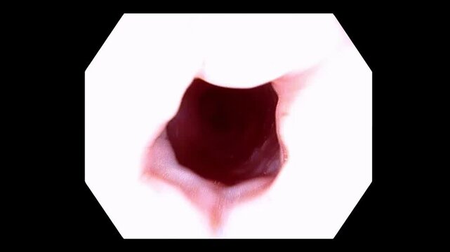 Image-Enhanced Endoscopy Mode Switching During Esophageal Examination