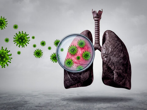 Human Lungs Infection with Virus Magnified View Medical Concept Illustration