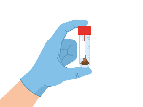 Gloved hand holding stool sample container for medical laboratory analysis