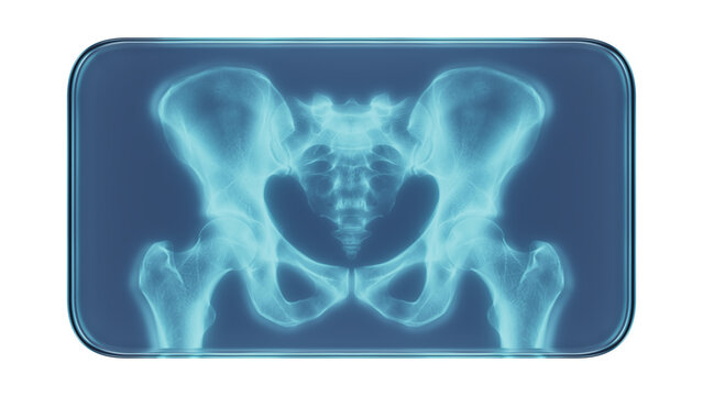 Glass Frame with X-Ray Human Pelvis Medical Illustration