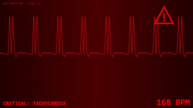 Digital heart rate monitor displaying normal rhythm and pulse