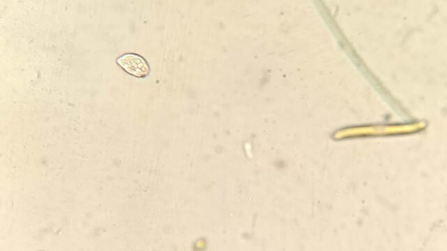 Stalked Colonial Ciliates Feeding in Freshwater Pond Water under Microscope