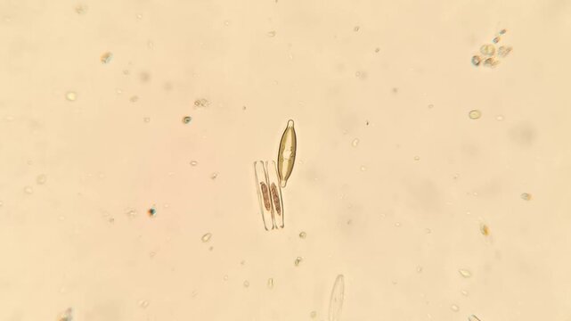 Freshwater Diatoms Showing Glass Cell Walls under Brightfield Microscopy