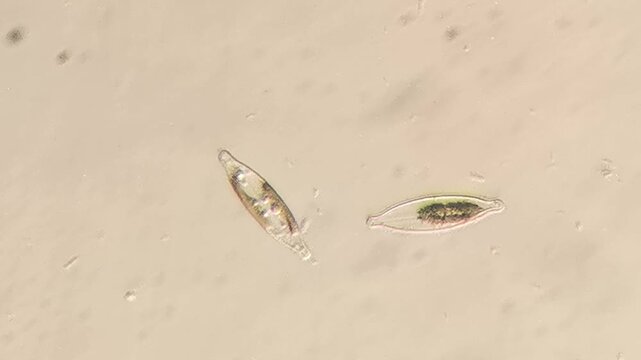 Freshwater Diatoms Showing Glass Cell Walls under Brightfield Microscopy