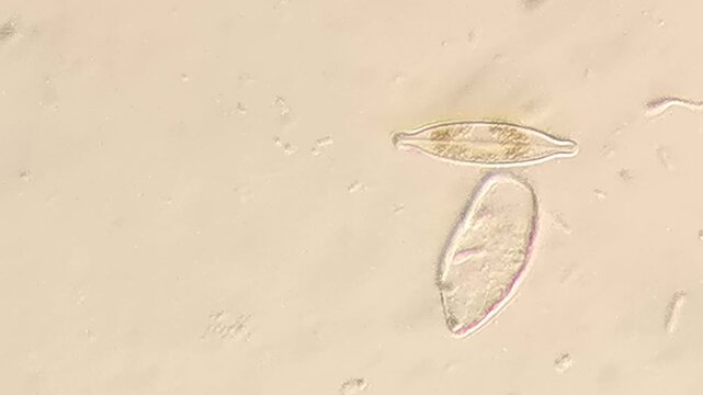 Golden Brown Diatoms with Chloroplasts Drifting in Pond Water Sample