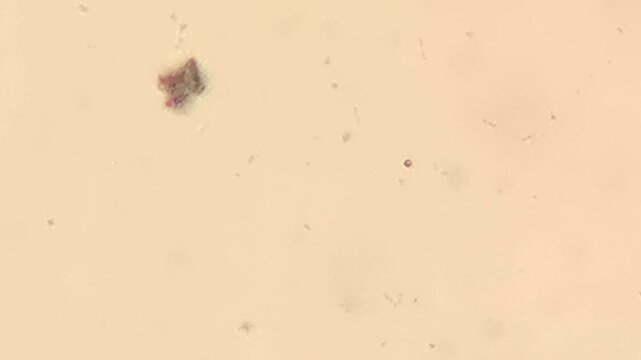 Needle Shaped Diatoms Floating among Organic Particles in Pond Water