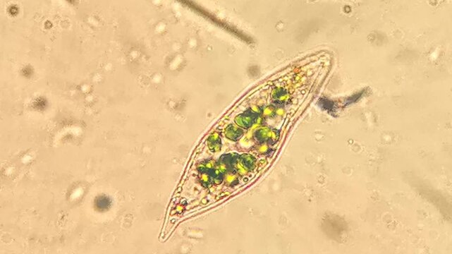 Boat Shaped Diatom Cells Swimming in Pond Water Microscopic View