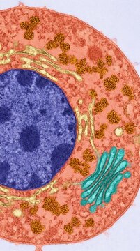 Infected cell showing hantavirus viral replication, assembly within cytoplasm, containing nucleus, endoplasmic reticulum, Golgi apparatus, false-color transmission electron microscopy view.