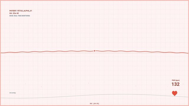 Fetal heart rate monitor display showing heartbeat data