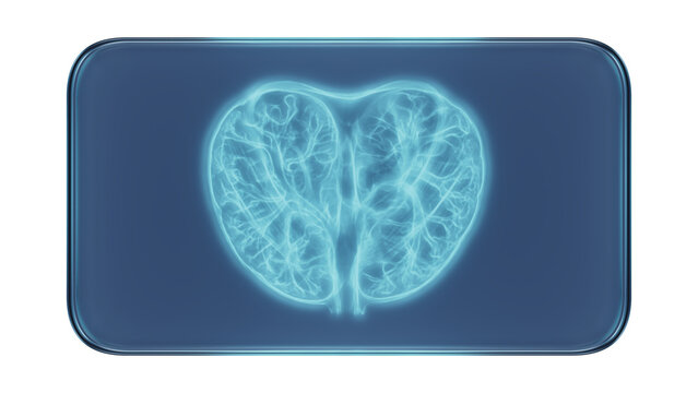 Glass Frame with X-Ray Human Prostate Medical Illustration