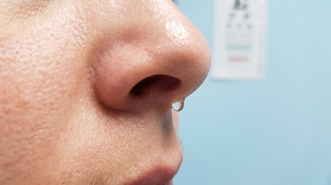 Runny Nose and Rhinorrhea &mdash; Clean ENT Medical Background with Copy Space