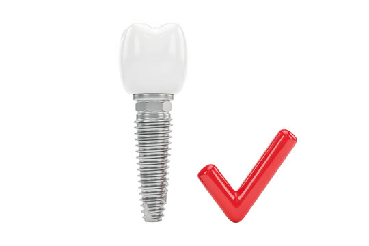 A3d rendered dental implant featuring a white crown and a metallic screw, positioned next to a glossy red checkmark on a white background