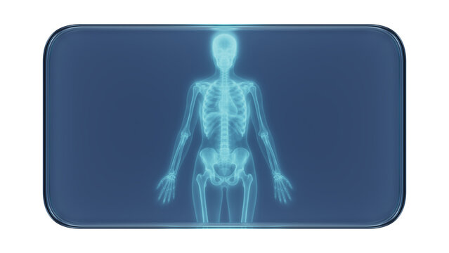 Glass Frame with X-Ray Human Skeleton Body Illustration  