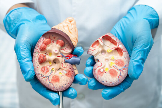 Kidney disease, Chronic kidney disease ckd, Doctor hold human model to treat and study in hospital.