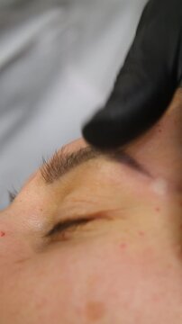 Professional cosmetologist making botox injection in female forehead close up. Doctor giving mesotherapy injections to patient face in beauty clinic - Vertical Video