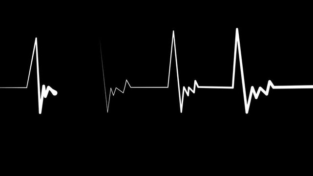 Heart monitor line medical pulse pattern with a flat section and sharp spikes animation