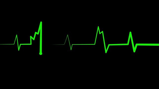 Abnormal heart rhythm line showing an ekg style medical waveform animation