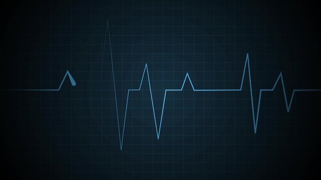 Ekg style line graph on a grid background with glowing peaks and dips animation, Heartbeat pulse signal and data chart concepts