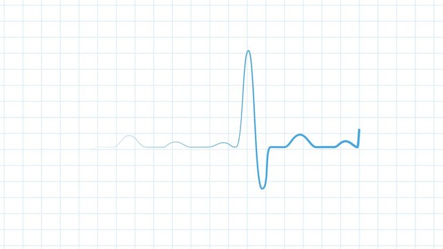 Minimal heartbeat line medical pulse graph with a sharp spike and calm empty space animation