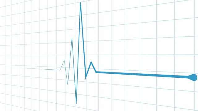 Minimal heartbeat line and sharp pulse spike wave animation