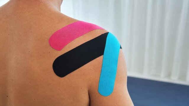 Colorful kinesiology tape applied across an adult shoulder and upper back, ideal for sports medicine, muscle support and physiotherapy