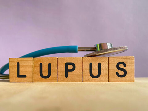Wooden blocks spelling LUPUS beside a stethoscope, representing lupus, autoimmune disease, chronic illness, medical diagnosis and healthcare awareness.