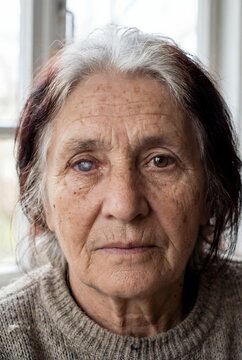 Elderly woman with severe corneal cataract and vision impairment looking at camera in a natural light portrait for ophthalmology and geriatric healthcare