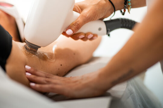 Professional laser epilation procedure in beauty clinic