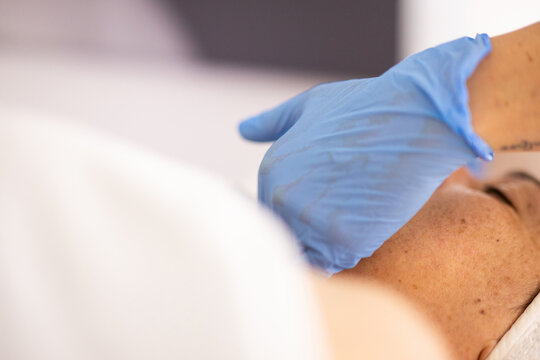 Protective glove during professional aesthetic treatment