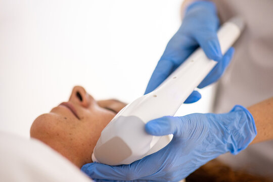 Advanced facial rejuvenation device treatment
