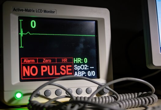 Medical monitor displaying no pulse alert with flatline ECG reading in emergency setting