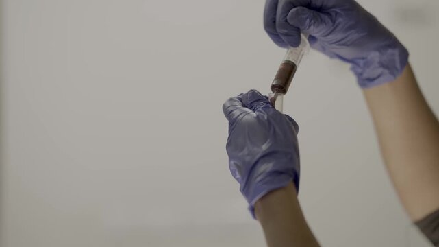 Laboratory Scientist Handling Syringe and Medical Sample in Gloves