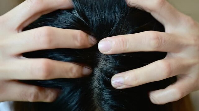 Close up of woman having itchy problem on her head cause of dandruff.