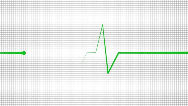 Heartbeat line wave signal showing a medical pulse pattern isolated animation
